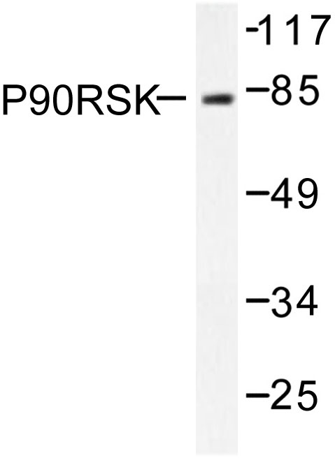 RPS6KA1 / RSK1 Antibody - Western blot of p90 RSK (Q374) pAb in extracts from 293 cells treated with PMA 125ng/ml 30'.