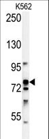 RPS6KA1 / RSK1 Antibody - RPS6KA1 Antibody western blot of K562 cell line lysates (35 ug/lane). The RPS6KA1 antibody detected the RPS6KA1 protein (arrow).