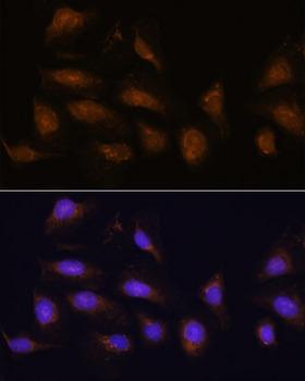 RPS6KA1 / RSK1 Antibody - Immunofluorescence analysis of U-2OS cells using P90RSK Polyclonal Antibody at dilution of 1:100.Blue: DAPI for nuclear staining.