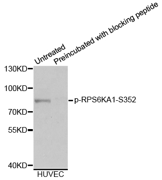 RPS6KA1 / RSK1 Antibody - Western blot analysis of extracts from HUVEC cells.