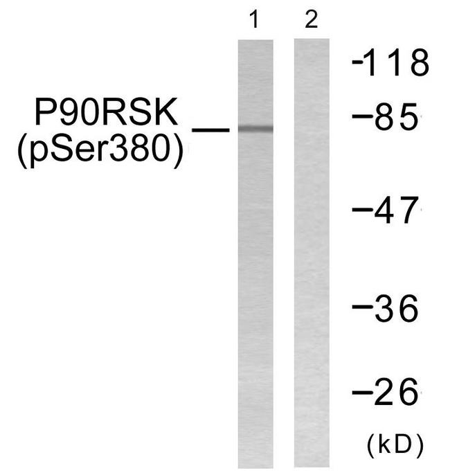 RPS6KA1 / RSK1 Antibody - Western blot analysis of lysates from 293 cells treated with PMA 125ng/ml 30', using p90 RSK (Phospho-Ser380) Antibody. The lane on the right is blocked with the phospho peptide.