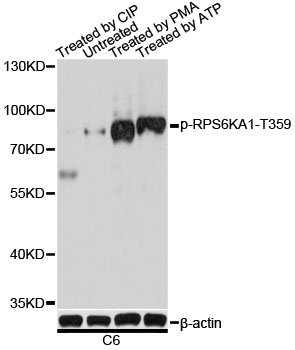 RPS6KA1 / RSK1 Antibody - Western blot analysis of extracts of various cell lines, using Phospho-RPS6KA1-S363 antibody at 1:2000 dilution or RPS6KA1 antibody. Hela cells were treated by ATP(5 mM) at 30â„ƒ for 1 hour. C6 cells were treated by PMA/TPA (200 nM) at 37â„ƒ for 30 minutes after serum-starvation overnight. The secondary antibody used was an HRP Goat Anti-Rabbit IgG (H+L) at 1:10000 dilution. Lysates were loaded 25ug per lane and 3% nonfat dry milk in TBST was used for blocking. Blocking buffer: 3% BSA.An ECL Kit was used for detection and the exposure time was 90s.