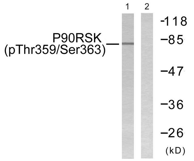RPS6KA1 / RSK1 Antibody - Western blot analysis of lysates from 293 cells treated with PMA 125ng/ml 30', using p90 RSK (Phospho-Thr359+Ser363) Antibody. The lane on the right is blocked with the phospho peptide.