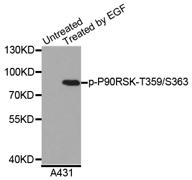 RPS6KA1 / RSK1 Antibody - Western blot analysis of extracts of A431 cells.