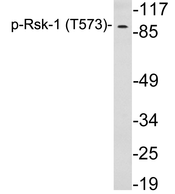 RPS6KA1 / RSK1 Antibody - Western blot analysis of lysates from 293 cells treated with PMA, using p-Rsk-1 (Phospho-Thr573) antibody.