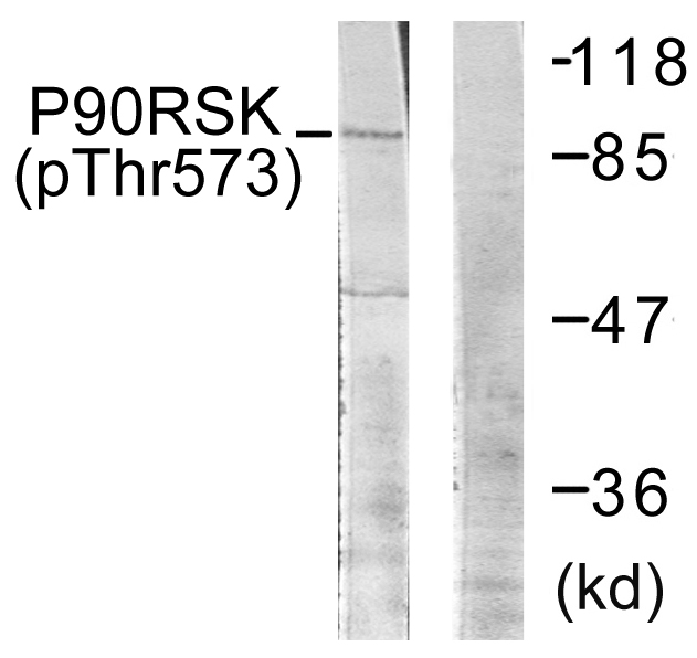 RPS6KA1 / RSK1 Antibody - Western blot of extracts from 293 cells, treated with UV (30mins), using p90 RSK (Phospho-Thr573) antibody.