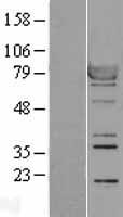 RPS6KA1 / RSK1 Protein - Western validation with an anti-DDK antibody * L: Control HEK293 lysate R: Over-expression lysate