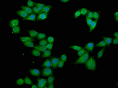 RPS6KA2 / RSK3 Antibody - Immunofluorescence staining of Hela cells with RPS6KA2 Antibody at 1:66, counter-stained with DAPI. The cells were fixed in 4% formaldehyde, permeabilized using 0.2% Triton X-100 and blocked in 10% normal Goat Serum. The cells were then incubated with the antibody overnight at 4°C. The secondary antibody was Alexa Fluor 488-congugated AffiniPure Goat Anti-Rabbit IgG(H+L).
