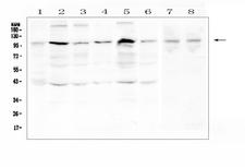 RPS6KA2 / RSK3 Antibody - Western blot analysis of RSK3 using anti-RSK3 antibody. Electrophoresis was performed on a 5-20% SDS-PAGE gel at 70V (Stacking gel) / 90V (Resolving gel) for 2-3 hours. The sample well of each lane was loaded with 50ug of sample under reducing conditions. Lane 1: human placenta tissue lysates,Lane 2: human Hela whole cell lysate,Lane 3: human PC-3 whole cell lysate,Lane 4: human A431 whole cell lysate,Lane 5: human K562 whole cell lysate,Lane 6: human PANC-1 whole cell lysate,Lane 7: rat testis tissue lysates,Lane 8: mouse testis tissue lysates. After Electrophoresis, proteins were transferred to a Nitrocellulose membrane at 150mA for 50-90 minutes. Blocked the membrane with 5% Non-fat Milk/ TBS for 1.5 hour at RT. The membrane was incubated with rabbit anti-RSK3 antigen affinity purified polyclonal antibody at 0.5 µg/mL overnight at 4°C, then washed with TBS-0.1% Tween 3 times with 5 minutes each and probed with a goat anti-rabbit IgG-HRP secondary antibody at a dilution of 1:10000 for 1.5 hour at RT. The signal is developed using an Enhanced Chemiluminescent detection (ECL) kit with Tanon 5200 system. A specific band was detected for RSK3 at approximately 90-100KD. The expected band size for RSK3 is at 83KD.