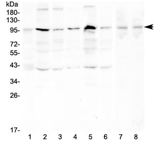 RPS6KA2 / RSK3 Antibody - Western blot testing of human 1) placenta, 2) HeLa, 3) PC-3, 4) A431, 5) K562, 6) PANC-1, 7) rat testis and 8) mouse testis with RSK3 antibody at 0.5ug/ml. Expected molecular weight ~90 kDa.