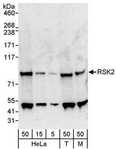 RPS6KA3 / RSK2 Antibody - Detection of Human and Mouse RSK2 by Western Blot. Samples: Whole cell lysate from HeLa (5, 15 and 50 ug), 293T (T; 50 ug), and mouse NIH3T3 (M; 50 ug) cells. Antibody: Affinity purified rabbit anti-RSK2 antibody used for WB at 0.4 ug/ml. Detection: Chemiluminescence with an exposure time of 30 seconds.