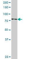 RPS6KA3 / RSK2 Antibody - RPS6KA3 monoclonal antibody (M01), clone 2G10. Western Blot analysis of RPS6KA3 expression in HepG2.