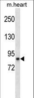 RPS6KA3 / RSK2 Antibody - RPS6KA3 Antibody western blot of mouse heart tissue lysates (35 ug/lane). The RPS6KA3 antibody detected the RPS6KA3 protein (arrow).