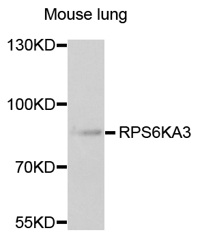 RPS6KA3 / RSK2 Antibody - Western blot analysis of extracts of mouse lung.