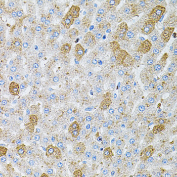 RPS6KA3 / RSK2 Antibody - Immunohistochemistry of paraffin-embedded rat liver tissue.