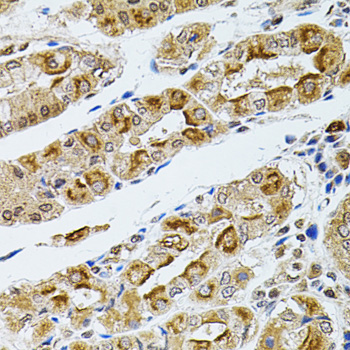 RPS6KA3 / RSK2 Antibody - Immunohistochemistry of paraffin-embedded human stomach tissue.