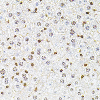 RPS6KA3 / RSK2 Antibody - Immunohistochemistry of paraffin-embedded mouse liver tissue.