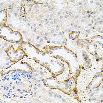 RPS6KA3 / RSK2 Antibody - Immunohistochemistry of paraffin-embedded mouse kidney tissue.