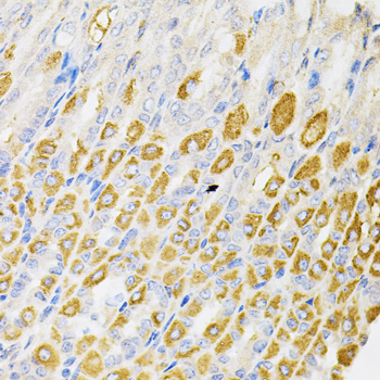 RPS6KA3 / RSK2 Antibody - Immunohistochemistry of paraffin-embedded mouse stomach tissue.