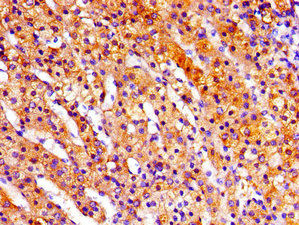 RPS6KA3 / RSK2 Antibody - Immunohistochemistry image of paraffin-embedded human adrenal gland tissue at a dilution of 1:100