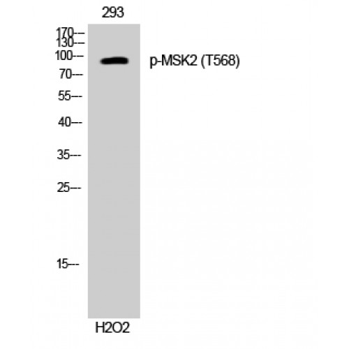 RPS6KA4 / MSK2 / RSK-B Antibody - Western blot of Phospho-MSK2 (T568) antibody
