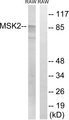 RPS6KA4 / MSK2 / RSK-B Antibody - Western blot analysis of lysates from Raw264.7 cells, treated with UV 5', using MSK2 Antibody. The lane on the right is blocked with the synthesized peptide.