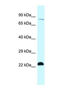 RPS6KA4 / MSK2 / RSK-B Antibody - RPS6KA4 / MSK2 antibody Western blot of Jurkat Cell lysate. Antibody concentration 1 ug/ml.  This image was taken for the unconjugated form of this product. Other forms have not been tested.