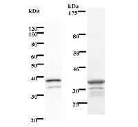 RPS6KA4 / MSK2 / RSK-B Antibody - Left : Western blot analysis of immunized recombinant protein, using anti-RPS6KA4 monoclonal antibody. Right : CBB staining of immunized recombinant protein.