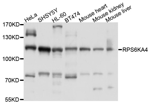 RPS6KA4 / MSK2 / RSK-B Antibody - Western blot analysis of extracts of various cell lines, using RPS6KA4 antibody at 1:1000 dilution. The secondary antibody used was an HRP Goat Anti-Rabbit IgG (H+L) at 1:10000 dilution. Lysates were loaded 25ug per lane and 3% nonfat dry milk in TBST was used for blocking. An ECL Kit was used for detection and the exposure time was 60s.