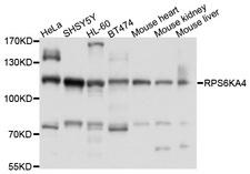 RPS6KA4 / MSK2 / RSK-B Antibody - Western blot analysis of extracts of various cell lines, using RPS6KA4 antibody at 1:1000 dilution. The secondary antibody used was an HRP Goat Anti-Rabbit IgG (H+L) at 1:10000 dilution. Lysates were loaded 25ug per lane and 3% nonfat dry milk in TBST was used for blocking. An ECL Kit was used for detection and the exposure time was 60s.