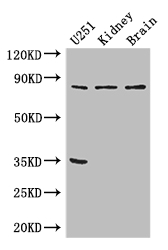 RPS6KA4 / MSK2 / RSK-B Antibody - Positive WB detected in:U251 whole cell lysate,Mouse kidney tissue,Mouse brain tissue;All lanes: RPS6KA4 antibody at 3ug/ml;Secondary;Goat polyclonal to rabbit IgG at 1/50000 dilution;Predicted band size: 86,85 kDa;Observed band size: 86 kDa;