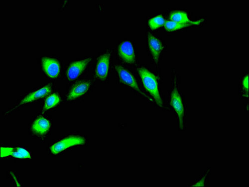 RPS6KA4 / MSK2 / RSK-B Antibody - Immunofluorescent analysis of Hela cells using RPS6KA4 Antibody at a dilution of 1:100 and Alexa Fluor 488-congugated AffiniPure Goat Anti-Rabbit IgG(H+L)
