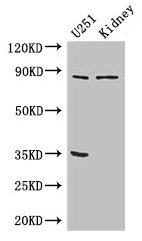 RPS6KA4 / MSK2 / RSK-B Antibody - Western Blot Positive WB detected in: U251 whole cell lysate, Mouse kidney tissue All lanes: RPS6KA4 antibody at 3µg/ml Secondary Goat polyclonal to rabbit IgG at 1/50000 dilution Predicted band size: 86, 85 kDa Observed band size: 86 kDa