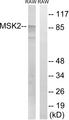 RPS6KA4 / MSK2 / RSK-B Antibody - Western blot analysis of extracts from RAW264.7 cells, treated with UV (5mins), using MSK2 (Ab-568) antibody.