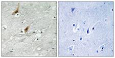 RPS6KA4 / MSK2 / RSK-B Antibody - Immunohistochemistry analysis of paraffin-embedded human brain, using MSK2 (Phospho-Thr568) Antibody. The picture on the right is blocked with the phospho peptide.