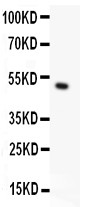 RPS6KA5 / MSK1 Antibody - MSK1 antibody Western blot. All lanes: Anti MSK1 at 0.5 ug/ml. WB: Recombinant Human MSK1 Protein 0.5ng. Predicted band size: 50 kD. Observed band size: 50 kD.