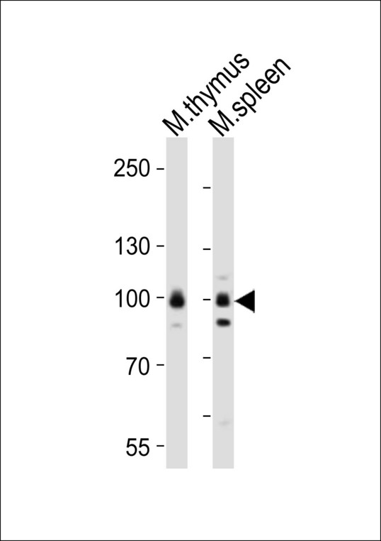RPS6KA5 / MSK1 Antibody - Western blot of lysates from mouse thymus, mouse spleen tissue lysate (from left to right) with Rps6ka5 Antibody. Antibody was diluted at 1:1000 at each lane. A goat anti-rabbit IgG H&L (HRP) at 1:10000 dilution was used as the secondary antibody. Lysates at 20 ug per lane.