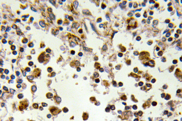 RPS6KA5 / MSK1 Antibody - IHC of MSK1 (Q577) pAb in paraffin-embedded human lymph node tissue.