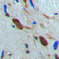 RPS6KA5 / MSK1 Antibody - Immunohistochemical analysis of MSK1 staining in human brain formalin fixed paraffin embedded tissue section. The section was pre-treated using heat mediated antigen retrieval with sodium citrate buffer (pH 6.0). The section was then incubated with the antibody at room temperature and detected using an HRP-conjugated compact polymer system. DAB was used as the chromogen. The section was then counterstained with hematoxylin and mounted with DPX.