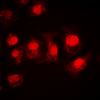 RPS6KA5 / MSK1 Antibody - Immunofluorescent analysis of MSK1 staining in HEK293T cells. Formalin-fixed cells were permeabilized with 0.1% Triton X-100 in TBS for 5-10 minutes and blocked with 3% BSA-PBS for 30 minutes at room temperature. Cells were probed with the primary antibody in 3% BSA-PBS and incubated overnight at 4 deg C in a humidified chamber. Cells were washed with PBST and incubated with a DyLight 594-conjugated secondary antibody (red) in PBS at room temperature in the dark. DAPI was used to stain the cell nuclei (blue).