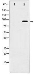 RPS6KA5 / MSK1 Antibody - Western blot of MSK1 expression in Mouse brain tissue lysates,The lane on the left is treated with the antigen-specific peptide.