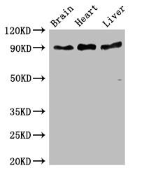 RPS6KA5 / MSK1 Antibody - Positive WB detected in:Mouse brain tissue,Rat heart tissue,Rat liver tissue;All lanes:RPS6KA5 antibody at 3?g/ml;Secondary;Goat polyclonal to rabbit IgG at 1/50000 dilution;Predicted band size: 90,62,82 KDa;Observed band size: 90 KDa;