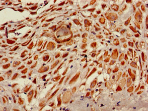 RPS6KA5 / MSK1 Antibody - Immunohistochemistry of paraffin-embedded human placenta tissue using RPS6KA5 Antibody at dilution of 1:100