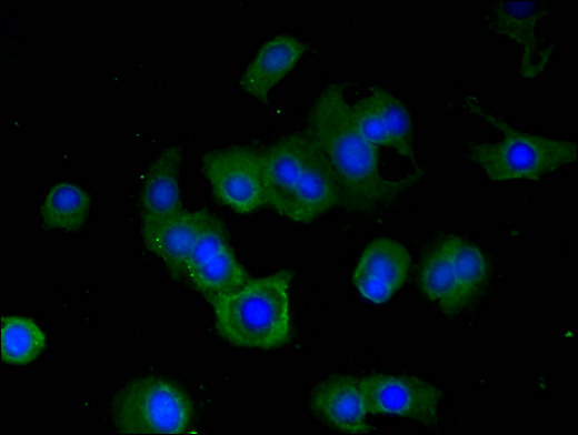 RPS6KA5 / MSK1 Antibody - Immunofluorescent analysis of MCF-7 cells using RPS6KA5 Antibody at a dilution of 1:100 and Alexa Fluor 488-congugated AffiniPure Goat Anti-Rabbit IgG(H+L)