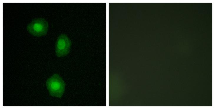 RPS6KA5 / MSK1 Antibody - Peptide - + Immunofluorescence analysis of A549 cells, using MSK1 (Ab-376) antibody.
