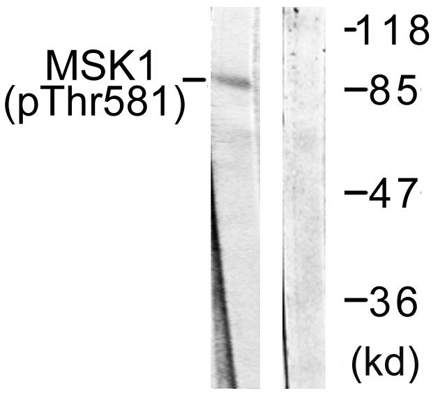 RPS6KA5 / MSK1 Antibody - Western blot analysis of extracts from 293 cells, treated with UV (15mins), using MSK1 (Ab-581) antibody.