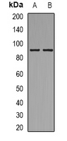 RPS6KA5 / MSK1 Antibody - Western blot analysis of MSK1 (pS212) expression in SHSY5Y (A); NIH3T3 (B) whole cell lysates.