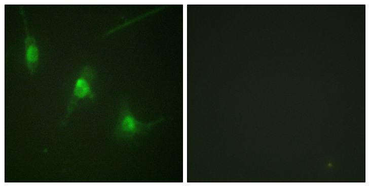 RPS6KA5 / MSK1 Antibody - Immunofluorescence analysis of NIH/3T3 cells, using MSK1 (Phospho-Ser360) Antibody. The picture on the right is blocked with the phospho peptide.