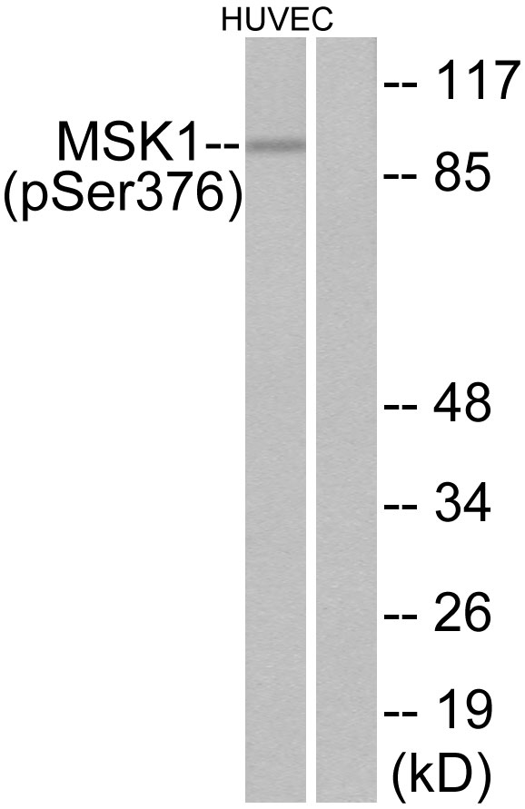 RPS6KA5 / MSK1 Antibody - Western blot analysis of lysates from HUVEC cells treated with PMA 125ng/ml 30', using MSK1 (Phospho-Ser376) Antibody. The lane on the right is blocked with the phospho peptide.