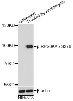 RPS6KA5 / MSK1 Antibody - Western blot analysis of extracts of NIH/3T3 cells, using Phospho-RPS6KA5-S376 antibody at 1:2000 dilution. NIH/3T3 cells were treated by Anisomycin (25ug/ml) for 30 minutes. The secondary antibody used was an HRP Goat Anti-Rabbit IgG (H+L) at 1:10000 dilution. Lysates were loaded 25ug per lane and 3% nonfat dry milk in TBST was used for blocking. Blocking buffer: 3% BSA.An ECL Kit was used for detection and the exposure time was 30s.